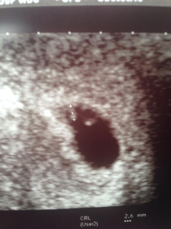 davebrfc's tweet image. #exstatic my announcement for today!!! #cantwait