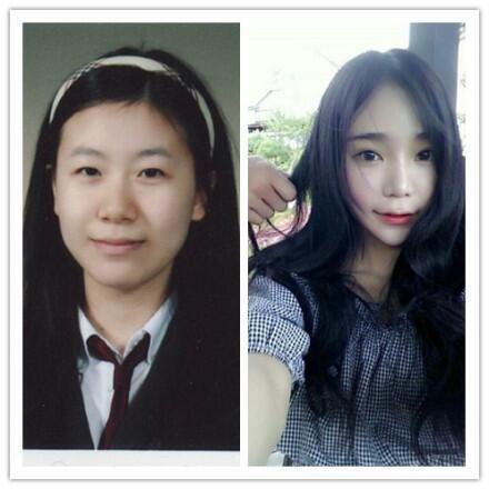 Kim Doyeon Before And After Plastic Surgery Http T Co 2wtmbzixor