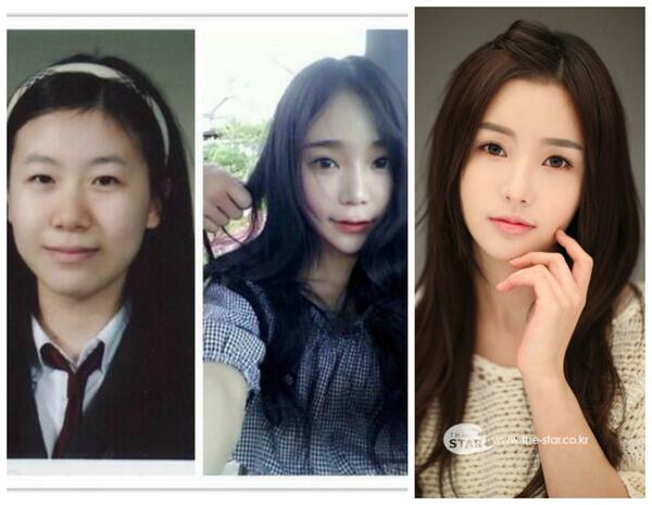 김화연 on twitter kim doyeon make same plastic surgery w actress