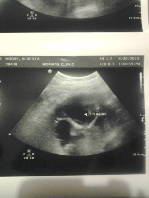 Team_Missy's tweet photo. OMG THEY SAID IT'S A FREAKING GIRL!!! http://t.co/PB9PKZUDvb