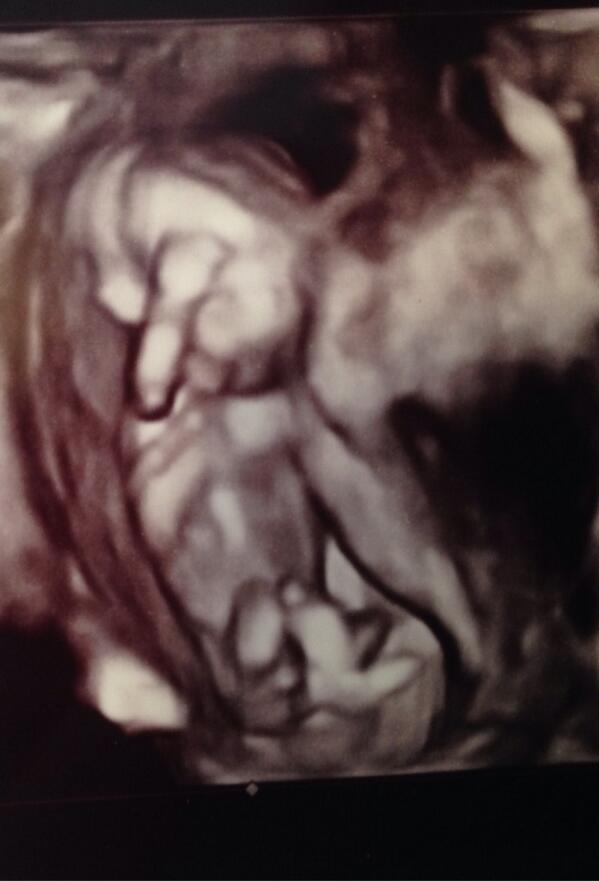 manda_sutton's tweet photo. Baby sutton on the wayy! 😍❤April 10th! ️ http://t.co/EA2y42Y6bP
