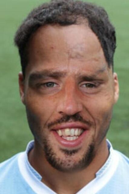 robboma24's tweet photo. Tonight the worlds 2 ugliest players could grace the same pitch.Here is a combined effort of them Meet frank lescott http://t.co/1ZJVp2AAGq