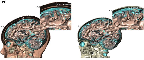 Marom Bikson tweet media