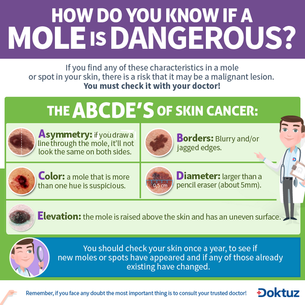 Doktuz's tweet photo. The ABCDE’s of #SKIN #CANCER. Share #Health, share @Doktuz . http://t.co/p1MdeCrIeB