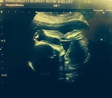 RaymiMurray's tweet image. Mine &amp;amp; Reece's little boyy can't wait to meet the little man&amp;lt;3 @bummy96