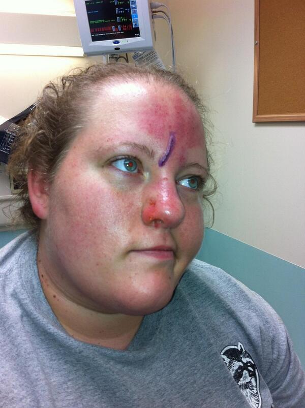 Fourwheeler wreck on Friday :)