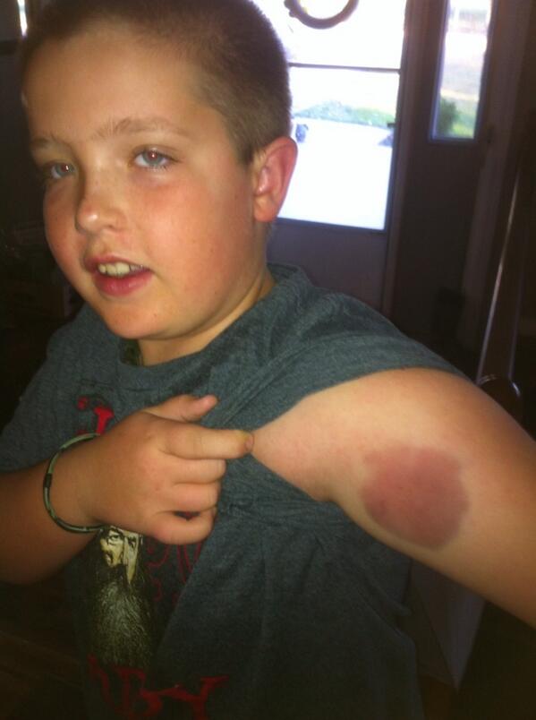 Kadens 10th birthday skeet shooting result