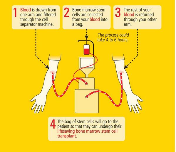 dkms_africa's tweet photo. How bone marrow stem cell donation works. So simple&amp;easy to save a life! Call 0800121082 to register @GarethCliff http://t.co/ba9CHSl9F8
