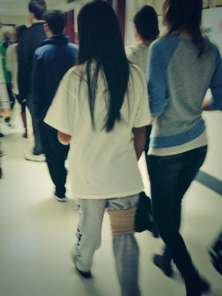 Share 71+ wearing knee brace over pants super hot - in.eteachers