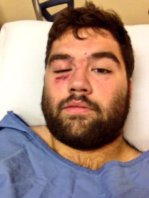 BradySinclair's tweet photo. Got KO'd on Monday #knockedout #monday #funday #dirtbike #204 #manitoba #motocross #tbt #toosoon http://t.co/SxDdsHtCou