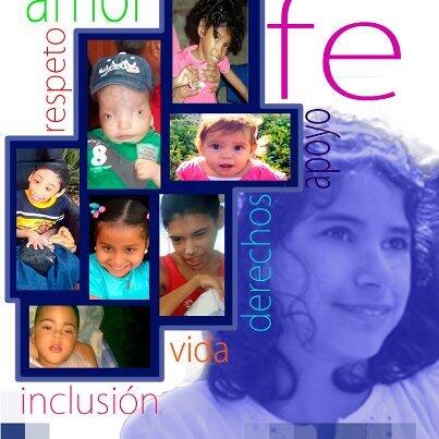 apoyo a la Fundación Amigos con SAI...