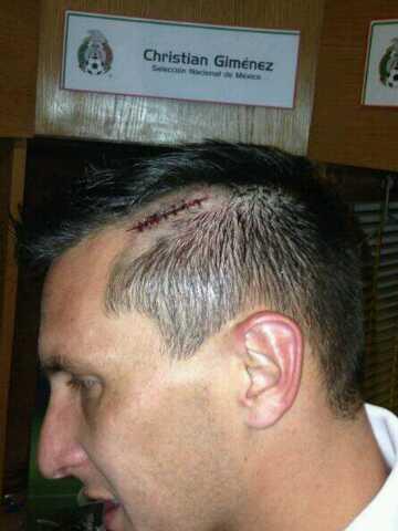 RAMORENORO's tweet photo. “@laaficion: Así quedó #Chaco Giménez tras sufrir una cabezazo en el #MéxicoPanamá http://t.co/3JLNBvyKs9 (Vía @AficioonAzul)” @ciintberman