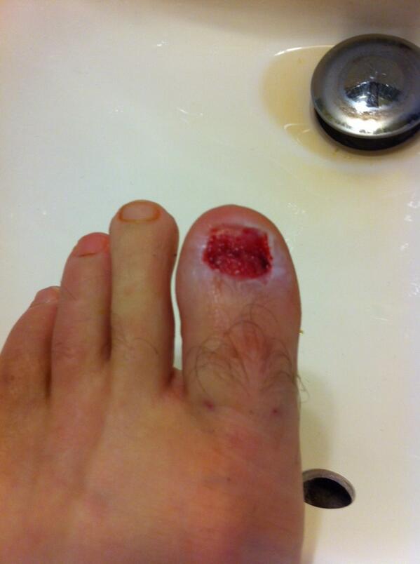 ommwilly's tweet photo. #ouch http://t.co/wiOmc2tAaP