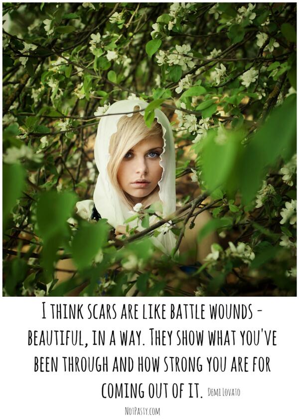 NotPasty's tweet image. Where are your #scars? What #beauty can you find in them?