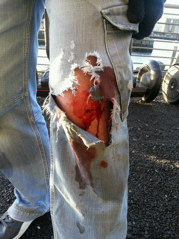 petebutton's tweet image. So who said you can't fall off a segway?