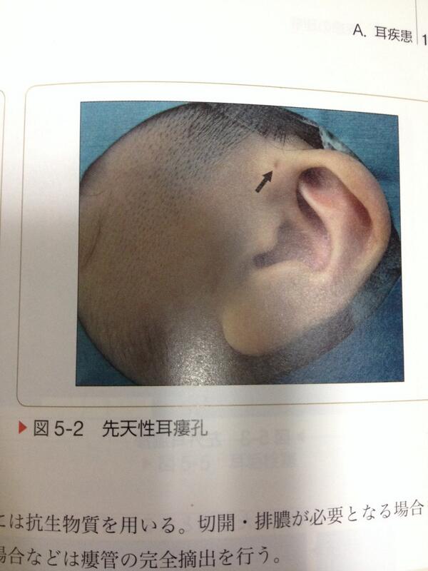 ま な Maaaaanaaaan Twitter ま な Maaaaanaaaan Twitter
