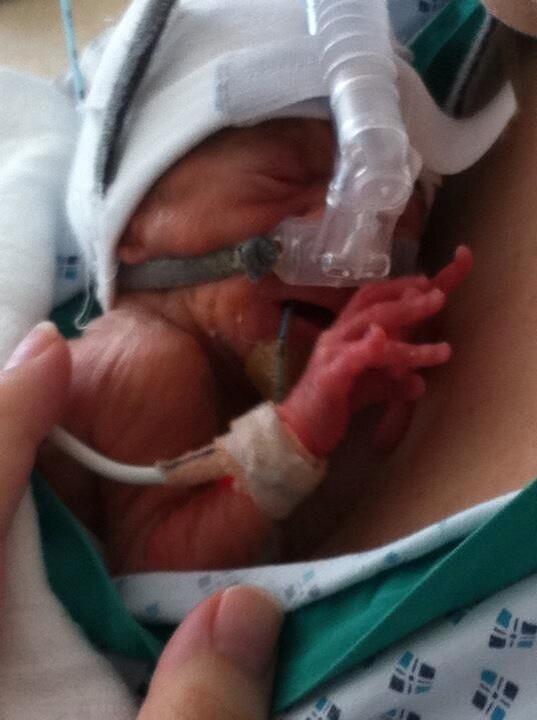 <a href="/Blisscharity/">Bliss Baby Charity</a> #TheImpossibleHug here is my contribution to this wonderful thing for #worldprematurityday