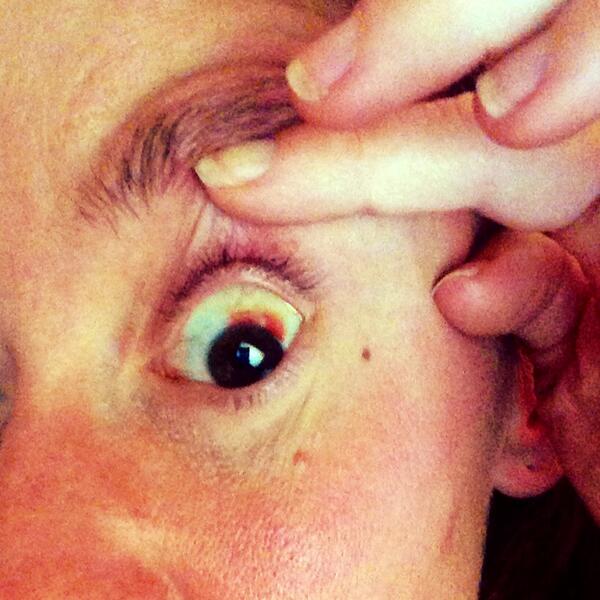 Sprayed Pepper Spray into eyes...
