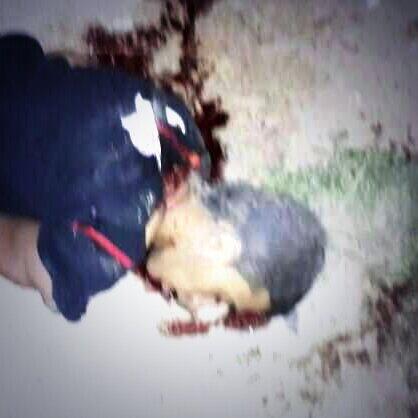 BuHSN's tweet photo. الصورة توضح ان رأس الشهيد علي الصباغ انفصل بشكل جزئي من جسده 
آه وا حسيناه #bahrain #البحرين http://t.co/8jbrnXKus1