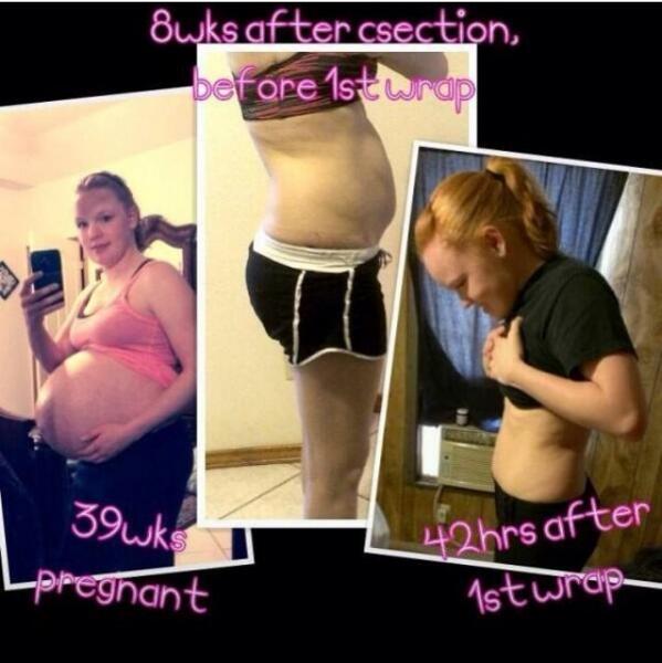 BLBodywraps's tweet image. It's the hardest after a c-section.. This mom did it, what's your excuse? Order today beautifullifestyles.myitworks.com
