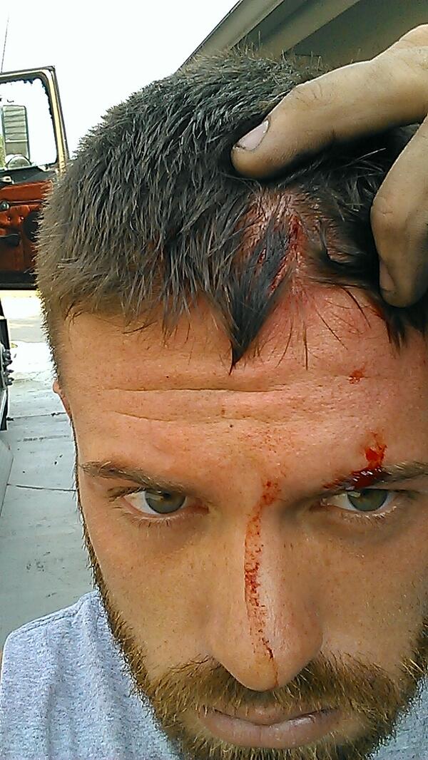 dgray43's tweet image. Just my luck busted head