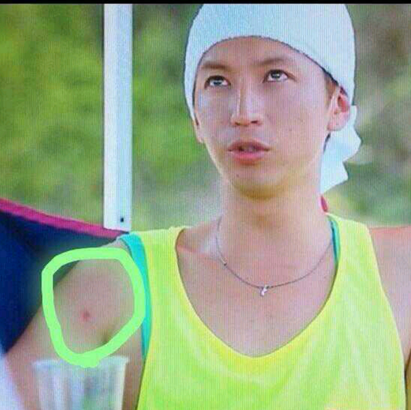 えむさん A Twitter 大倉って検索したら 大倉 キスマークって 出てきて焦ったww これ キスマークなん Wwww ただの虫さされやと思っててんけどw めっちゃ掻いてたしさw キスマークなんだとしたら私がつけたやつか もしれないw うん 黙るわw Http T Co