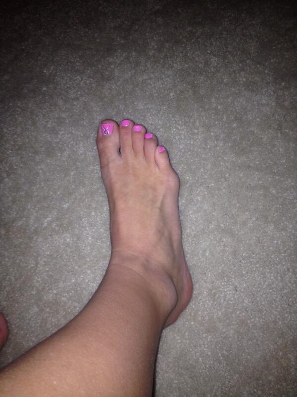 Maddie Weirick On Twitter Wellpppp That S A Dislocated Pinky Toe Hahaha Gymnasticscoachprobz Http T Co Cmxxzvbvcf Maddie Weirick On Twitter Wellpppp That S A Dislocated Pinky Toe Hahaha Gymnasticscoachprobz Http T Co Cmxxzvbvcf