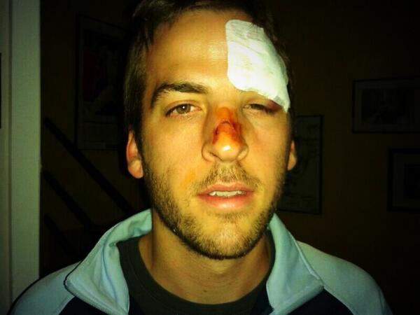 Mucho ánimo a nuestro compi, esta tarde pasara por el quirófano después de dejarse la cara en el campo 1 fuert abraz