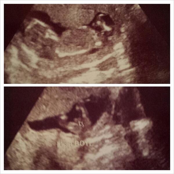 logenashford's tweet photo. Having a little boy !! :) http://t.co/5fCEc2Ckc0