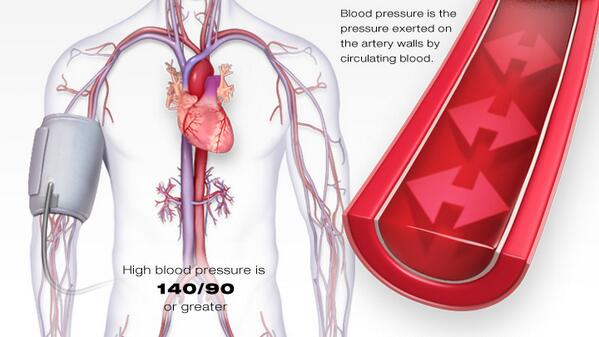 CPRTrainingPro's tweet image. High blood pressure increases your risk of heart attack and stroke. Check yours regularly! #savealife