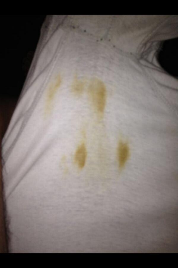 shitey_arse's tweet photo. Some Shitey undies for you all!!! 🎶Shit stains in your undies told a tale on you🎶 #scat #shit #shite #shitlovers http://t.co/rtQ8MFMjWl