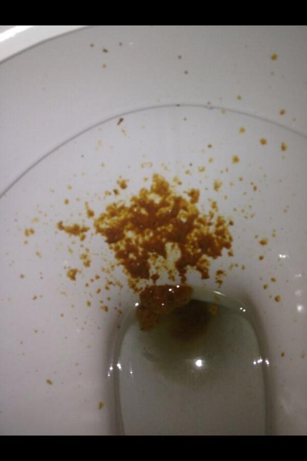 shitey_arse's tweet photo. 🎶Split splat I was taking a shat!🎶 @shitehoose http://t.co/9Dn7bohg96