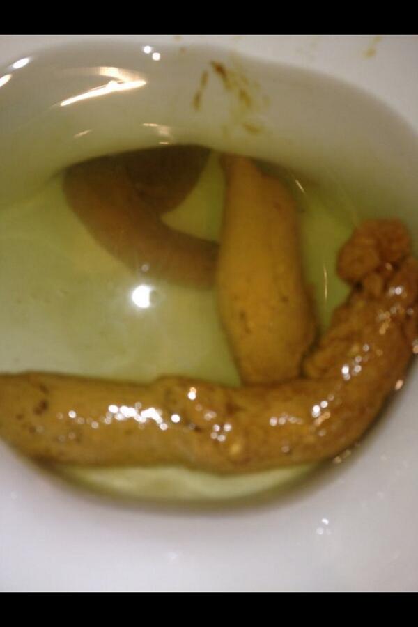 shitey_arse's tweet photo. Retweet if you spot the sweetcorn!!! http://t.co/X2DwO4Th1i