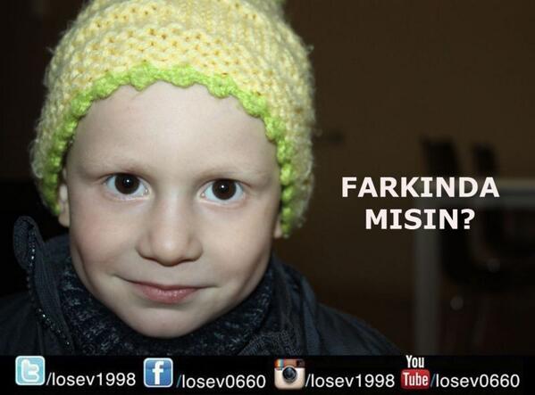 losev1998's tweet photo. Ayna ayna söyle bana?

2-8 Kasım Lösemili Çocuklar Haftası #YaşasınLösemiliÇocuklar http://t.co/9x9xoEs0RF http://t.co/VHdBz47jRk
