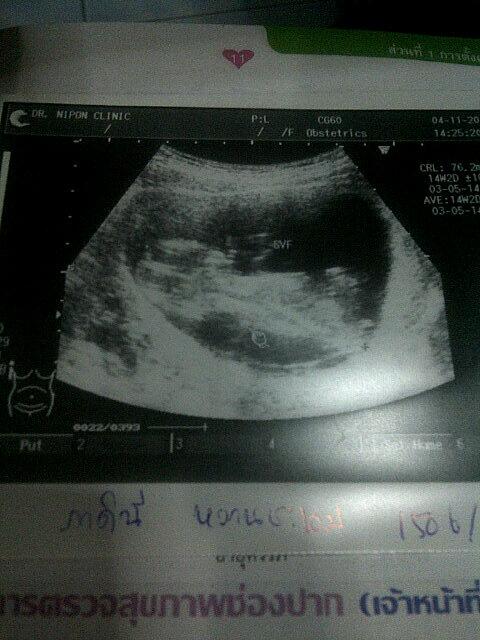 goy7's tweet photo. I love you http://t.co/GbrncGjOPd