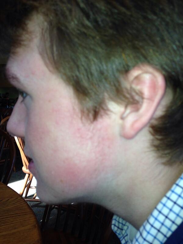 Roller_Daddys's tweet photo. Shoutout to the bench warmer with the best no shave November in the league @Burnseyyyy #AssBurgers #grease http://t.co/CxCViWmD1l