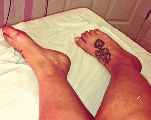 EmilyMBennett's tweet photo. Who knew this would be relaxing? #acupucture #needles http://t.co/cMr8jnCK5u