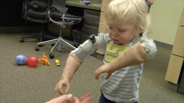 fox12oregon's tweet photo. Born with only partial arms, one-year-old boy tests out his new bionic arms in Portland http://t.co/UwN23bKivm http://t.co/jrkYE3K6em