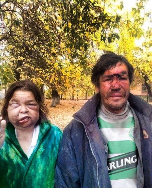 JimmyL1912's tweet photo. Just arrived back from Amsterdam complaining of police brutality http://t.co/ZIOxbwNvOX