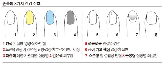 Beautipull_Kor's tweet photo. 8가지 손톱 상태로 알아보는 건강상태~!

(* 피부고민이 있을땐? 피부꿀팁 No.1 <뷰티풀> http://t.co/6M5oSCDUdw) http://t.co/Wu0VyQCfBx