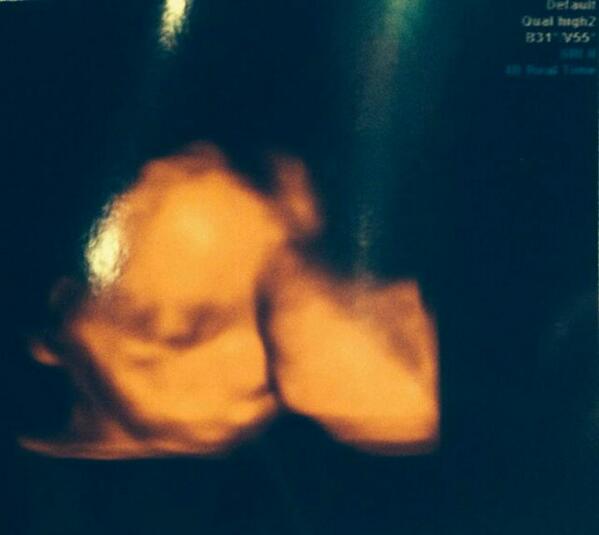 RaymiMurray's tweet image. Mine and Reece's 3D scan aw are baby boy so beautiful love him so much&amp;lt;3xxx @bummy96
