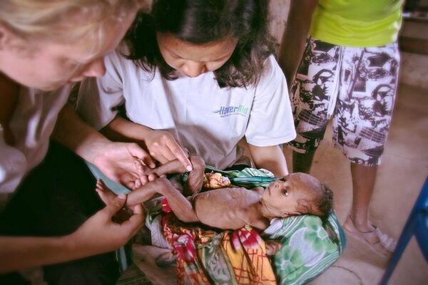 Deze ondervoedde baby heeft onze hulp hard nodig. We doen dat graag met jou, help je mee?