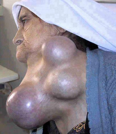 امانة برقبتك ليوم الدين لاتخرج قبل ان تضغط

#رتويت وتقول الله يشفيها

 ”

اسألك بلله تمررها لتصل لاكثر عدد من المسلمين