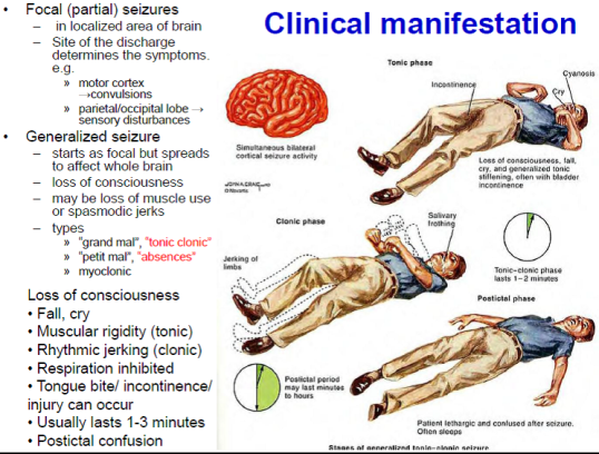 JanysVenne's tweet photo. Guide To Understand Tonic Clonic #Seizures at http://t.co/szA5hAePUR http://t.co/zX5ZR5jm12