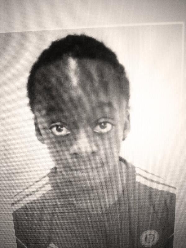 Biggest Forehead In The World