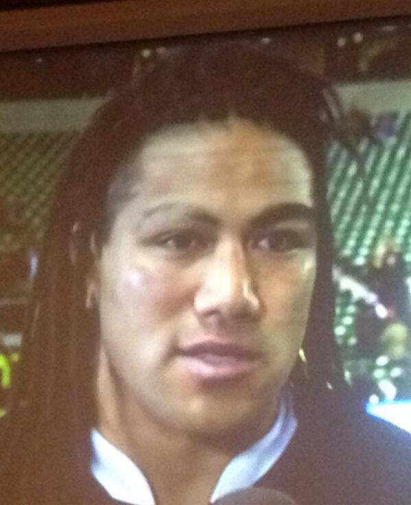 MorgsNZ's tweet photo. @maavelous what happened to the eyebrow bro ? @CoryJane1080 have something to do with this ?? #hurricane4life http://t.co/2wDRALVfs8