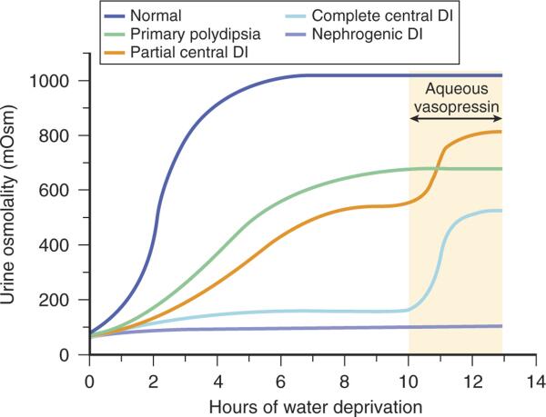 Usmle Aid Ar Twitter Water Deprivation Test Usmle Endocrinology Meded Foamed Http T Co Jrqhrrgqkk Twitter