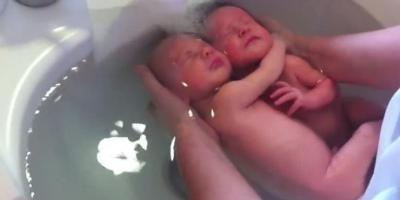 ou_wee's tweet photo. subhanalloh... RT @kompascom: Menakjubkan, Setelah Lahir Bayi Kembar Ini Tetap Berpelukan http://t.co/9rtQrKQNnv http://t.co/MlxdnvPVEs