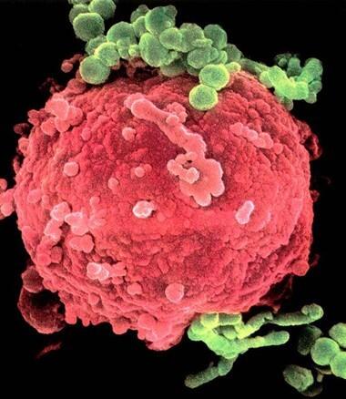 ChinaHealthMark's tweet image. @Tsinghua_China University proved Hsp90α as the #biomark for #tumors for the first time. researchinchina.com/news/NewsInfo.…