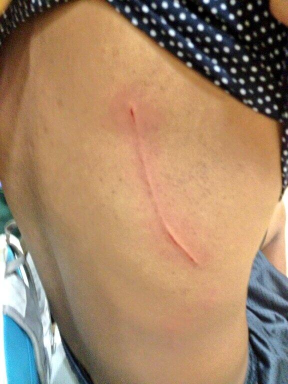 BossFlowJunior's tweet image. I survived another day :'( lmao #PoorBack